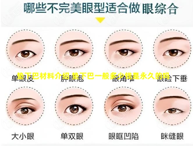 垫下巴材料介绍 垫下巴一般多少钱是永久的吗